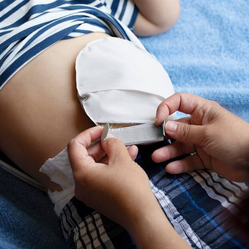 Meer informatie over de kinderlijn voor stomazorg