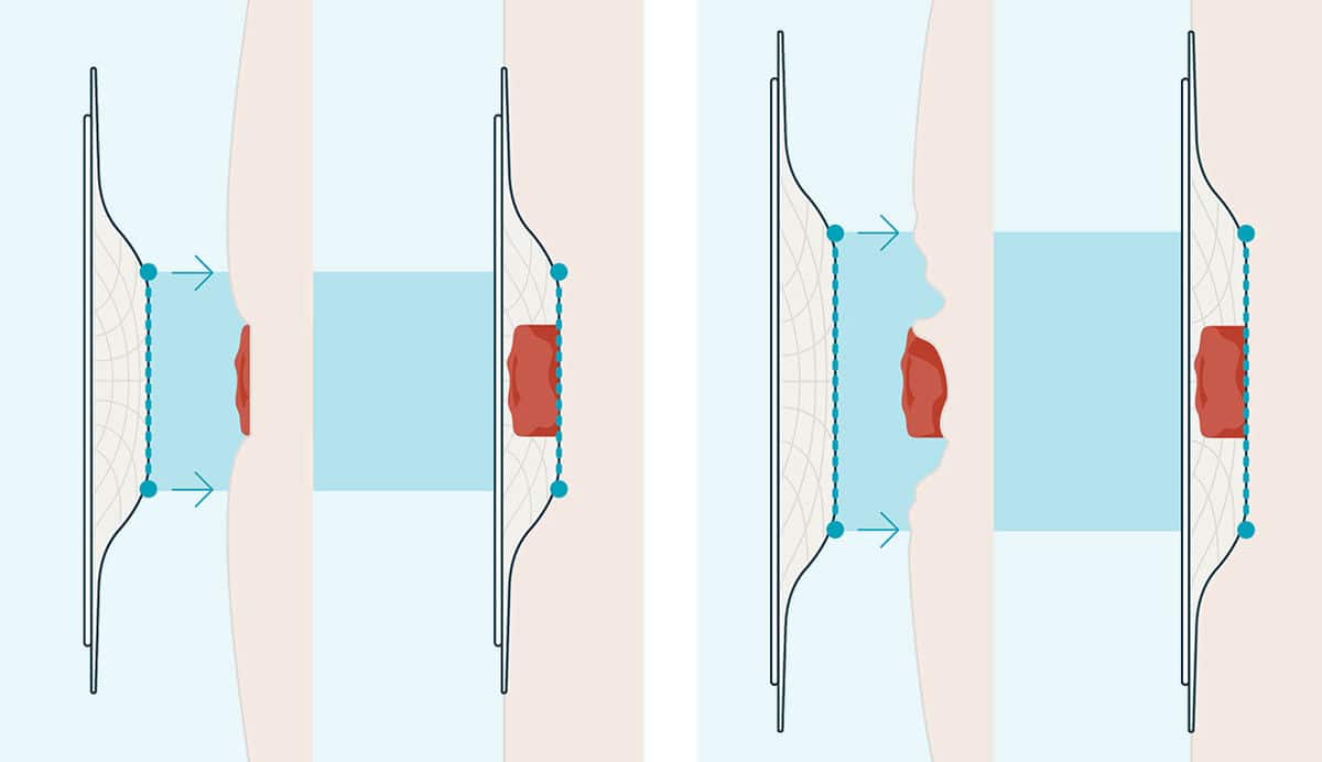 Het belang van het uitoefenen van de juiste druk³