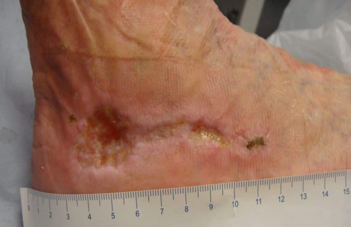 Holistic wound assessment