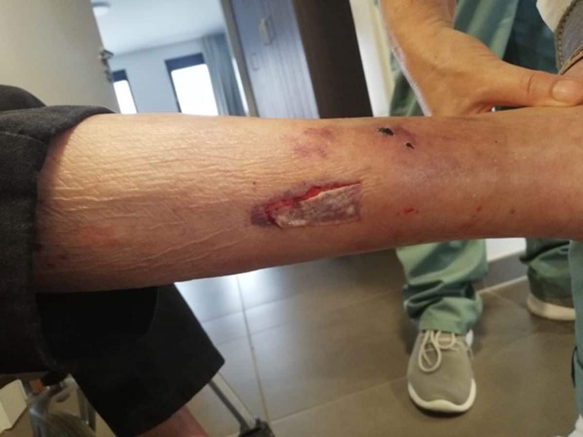 U kunt hydrocolloïden gebruiken: