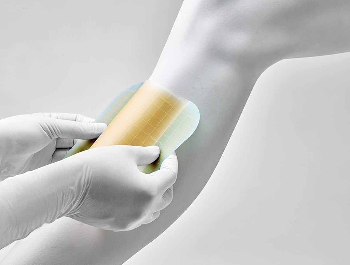 Wat zijn de voordelen van hydrocolloïd verbanden?