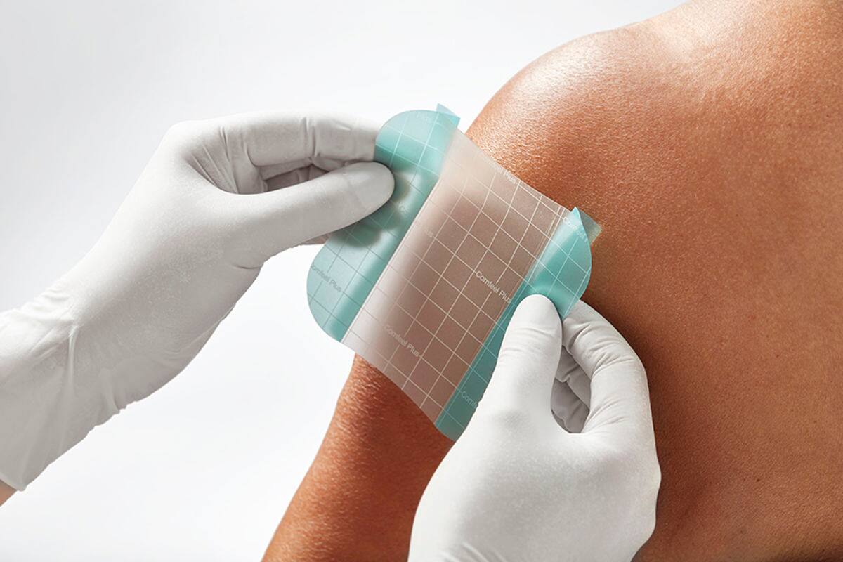 Hoe selecteer ik het juiste hydrocolloïd verband?