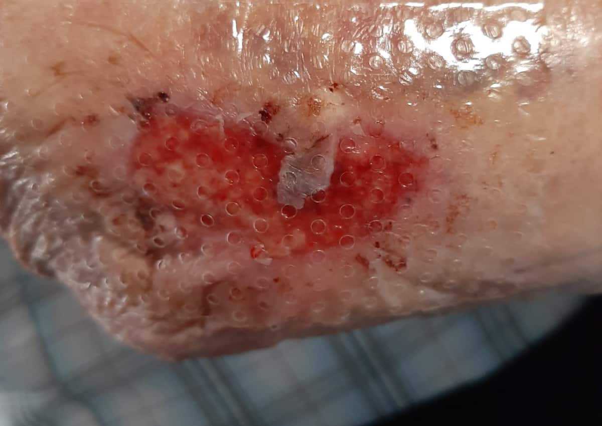 Kies het juiste verband