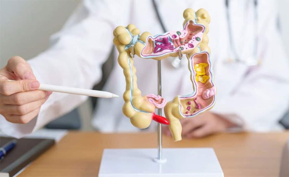 Leidraad voor het Behandelen van Patiënten met Neurogene Darmproblematiek